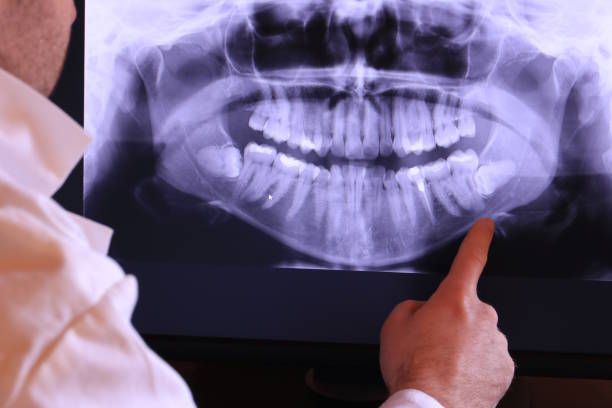 Best Emergency Root Canal Treatment in Ashaway, RI
