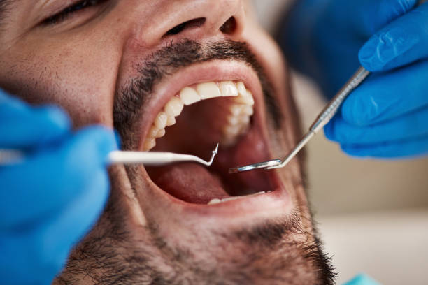 Best Walk-In Emergency Dentist in Ashaway, RI